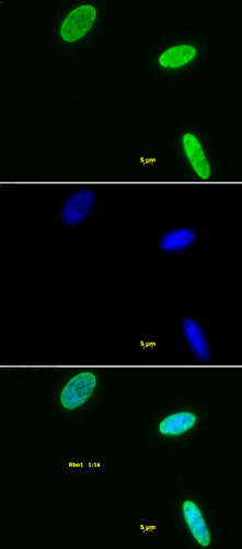 Histone H3K9me2 antibody (pAb) tested by immunofluorescence.