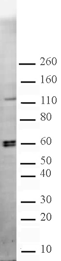 CARM1 antibody (pAb) tested by Western blot.