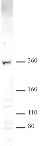 CHD2 antibody (pAb) tested by Western blot.