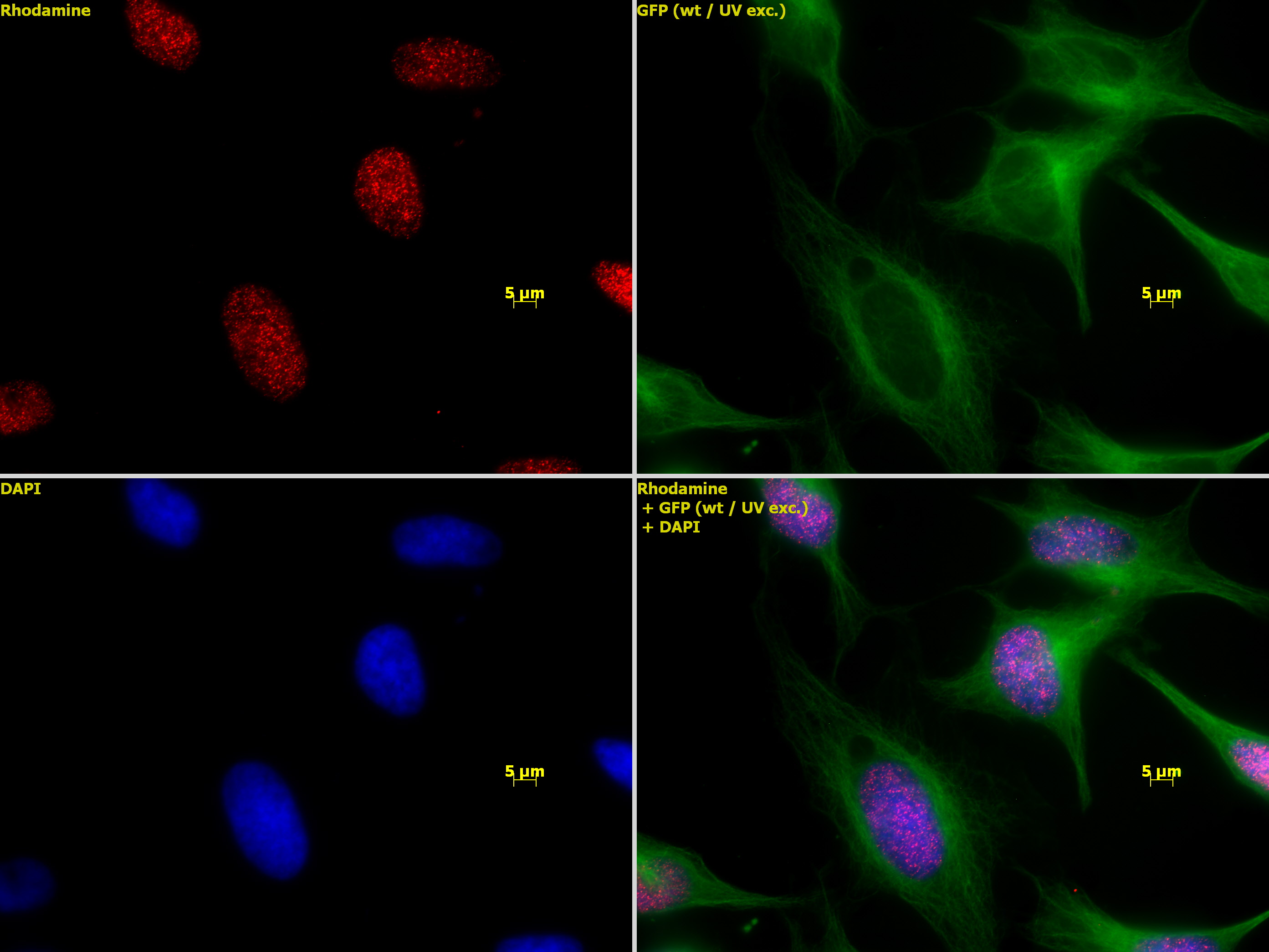 Histone H3K27me1 antibody (pAb) tested by immunofluorescence.