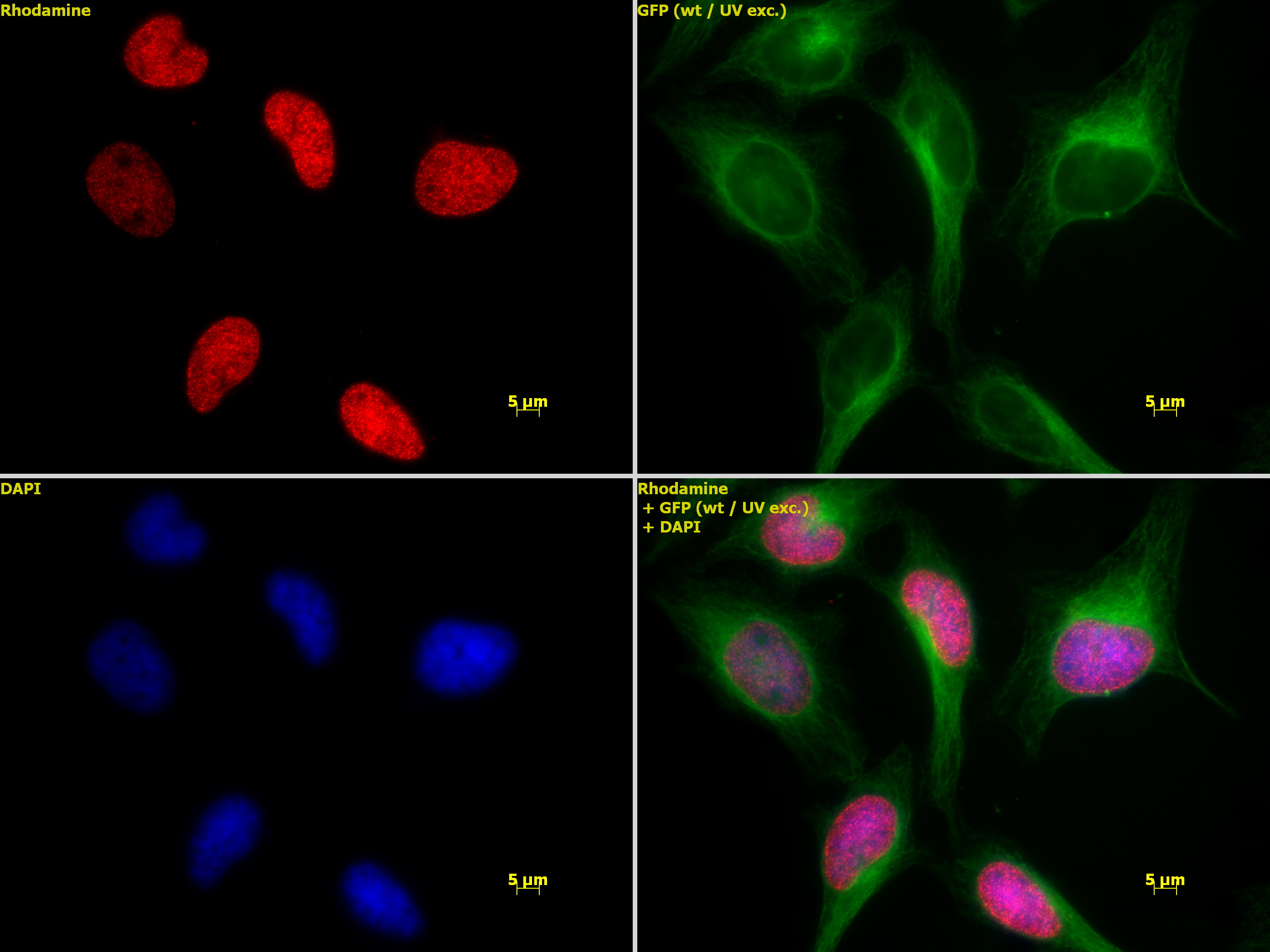 Histone H3K4ac antibody (pAb) tested by immunofluorescence.