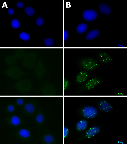 ATM phospho Ser1981 antibody (mAb) tested by immunofluorescence.