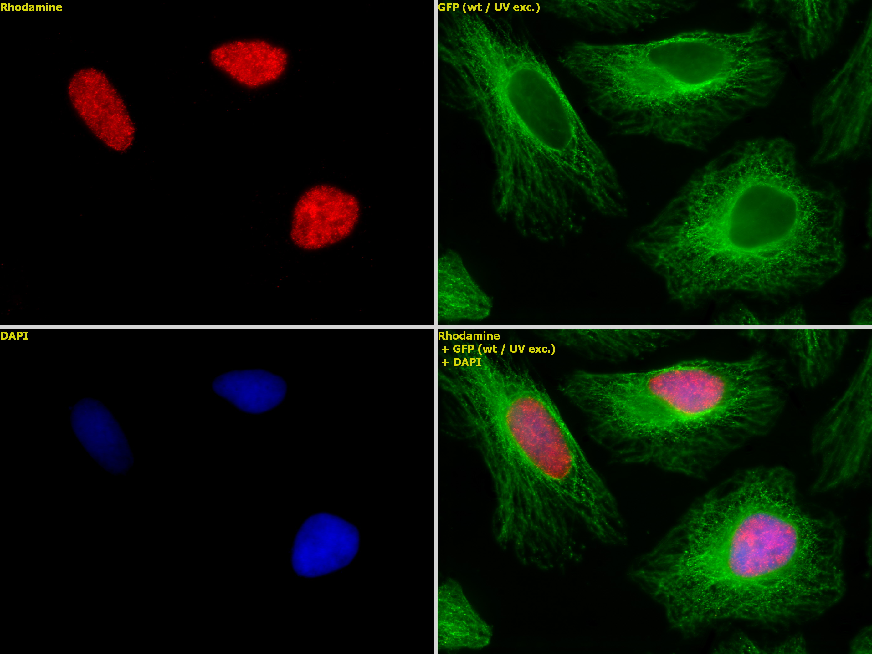 Histone H2BK46me2 antibody (pAb) tested by immunofluorescence.