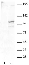 STAT2 phospho Tyr689 antibody (pAb) tested by Western blot.