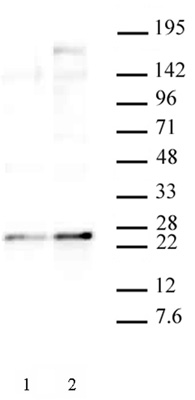 HP1 gamma phospho Ser93 antibody (pAb) tested by Western blot.