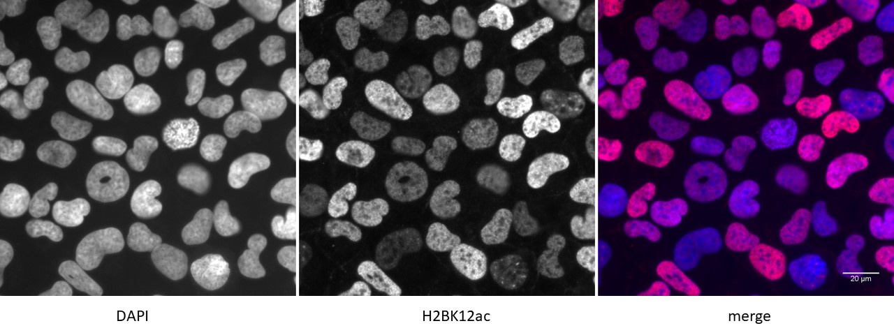 Histone H2BK12ac antibody (pAb) tested by immunofluorescence.