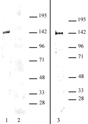 HDAC9 antibody (pAb) tested by Western blot.