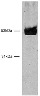 HNF-3β / FOXA2 antibody (pAb) tested by Western blot.