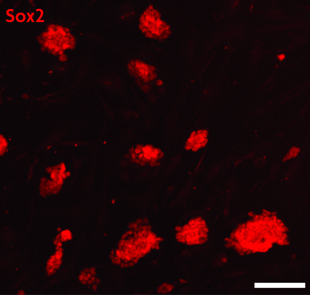 Sox2 antibody (pAb) tested by immunofluorescence.