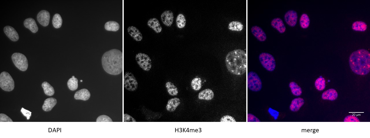 Histone H3K4me3 antibody (pAb) tested by immunofluorescence.