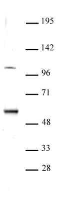 ELP3 antibody (pAb) tested by Western blot.