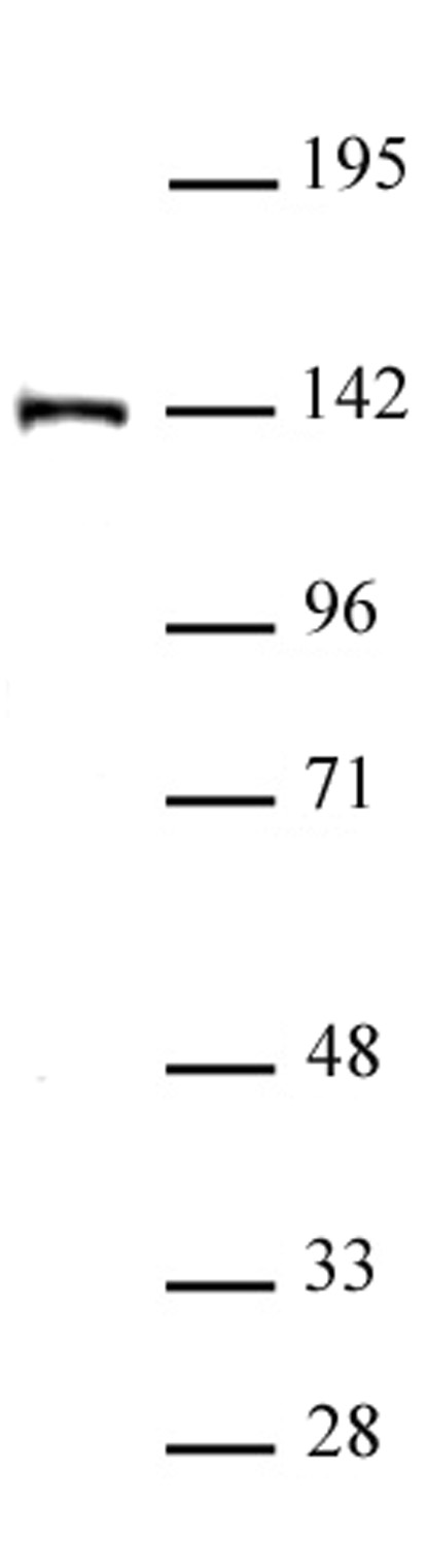 SALL4 antibody (pAb) tested by Western blot.