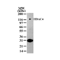 HDAC4 antibody (pAb) tested by Western blot.