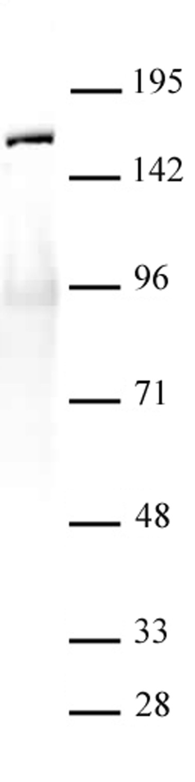 SMC1-α antibody (pAb) tested by Western blot.