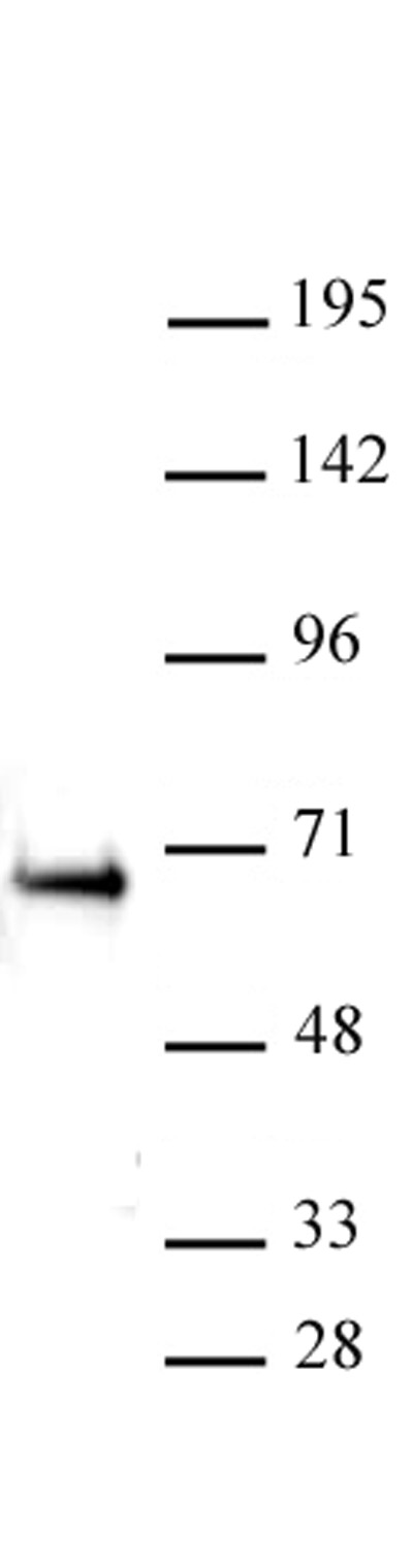 ETO / RUNX1T1 antibody (pAb) tested by Western blot.