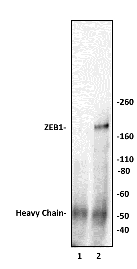 ZEB1 antibody (pAb) tested by immunoprecipitation.