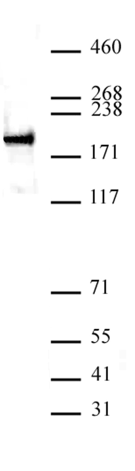 ZEB1 antibody (pAb) tested by Western blot.