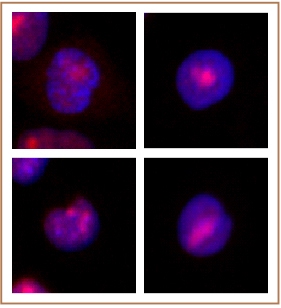 WRN antibody (mAb) tested by immunofluorescence.
