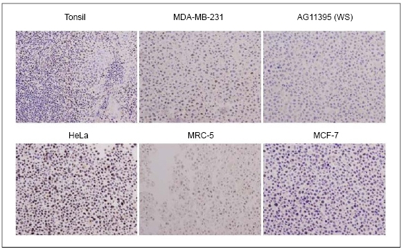 WRN antibody (mAb) tested by immunohistochemistry.