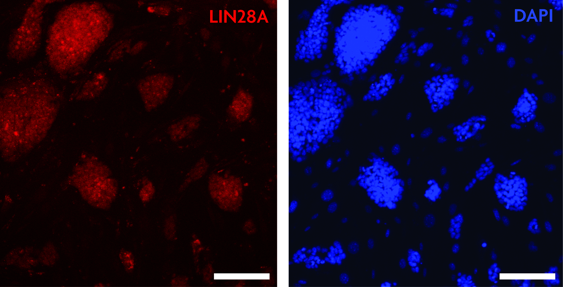 LIN28A antibody (pAb) tested by immunofluorescence.