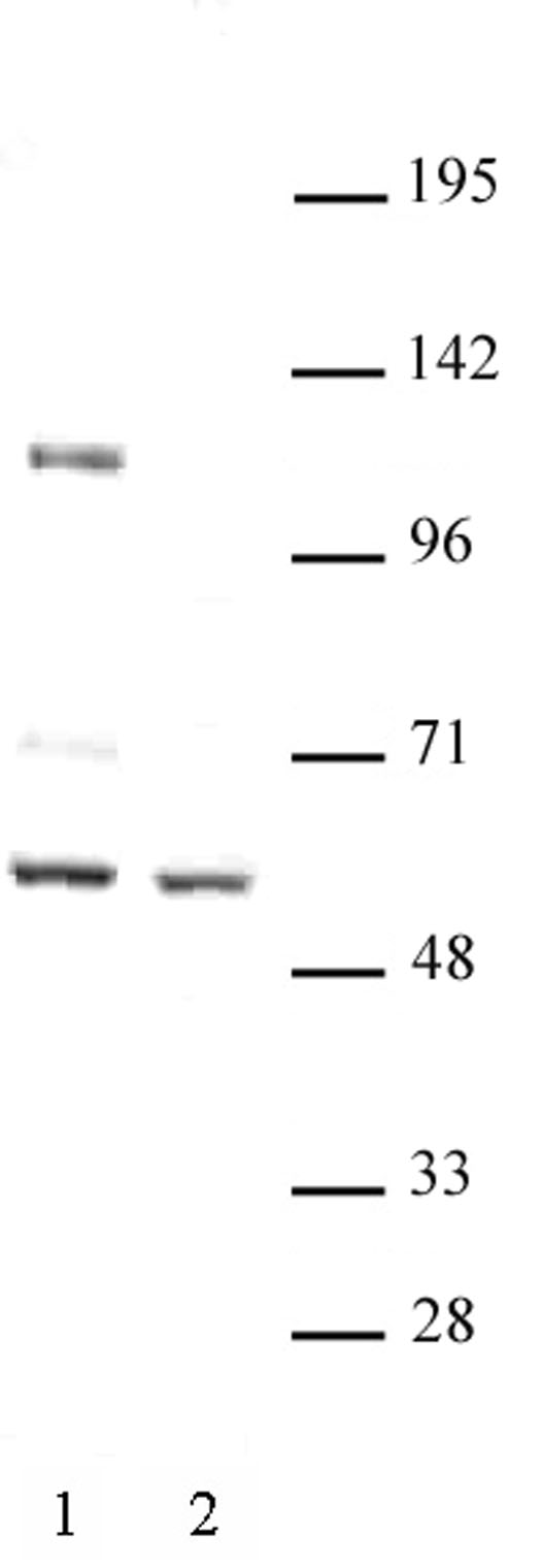 FOXG1 antibody (pAb) tested by Western blot.