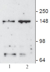 JMJD3 / KDM6B antibody (mAb) tested by Western blot.