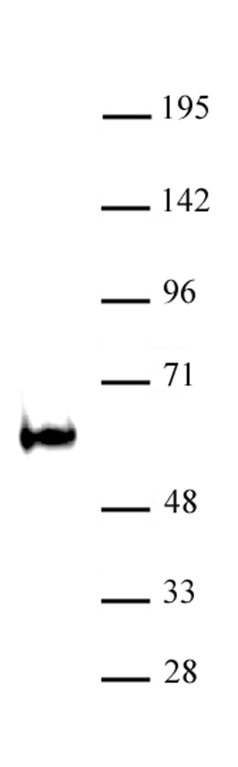 TDG / Thymine-DNA glycosylase antibody (pAb) tested by Western blot.