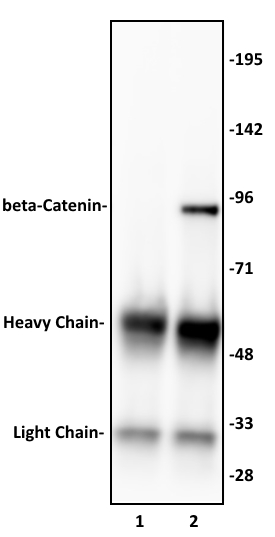 beta-Catenin antibody (pAb) tested by immunoprecipitation.