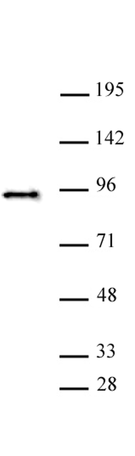 SATB2 antibody (pAb) tested by Western blot.