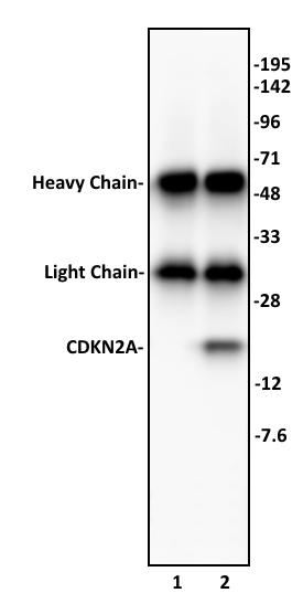 CDKN2A antibody (pAb) tested by immunoprecipitation.