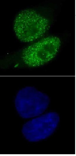 SMARCA4 antibody (mAb) tested by immunofluorescence.