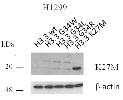 Histone H3.3K27M antibody (pAb) tested by Western blot.