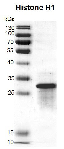 Recombinant Histone H1 protein gel