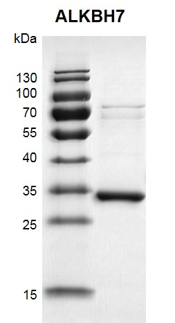 Recombinant ALKBH7 protein gel