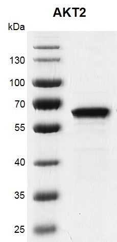 Recombinant AKT2 protein gel