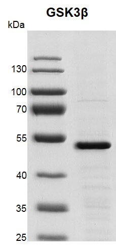 Recombinant GSK3&beta; protein