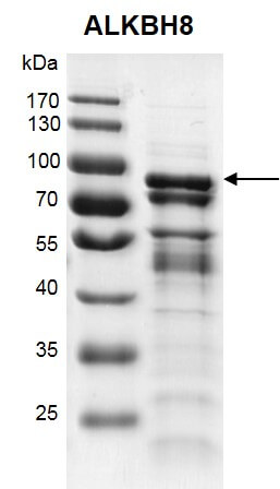 Recombinant ALKBH8 protein gel