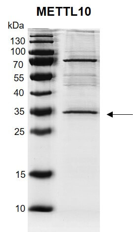 Recombinant METTL10 protein gel