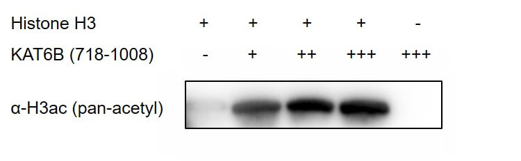 Recombinant KAT6B / MORF (718-1008) protein activity assay