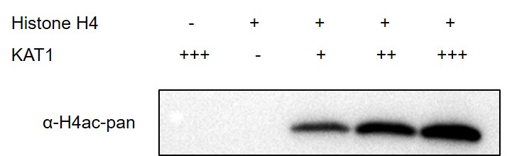 Western blot for Recombinant KAT1 / HAT1 protein activity