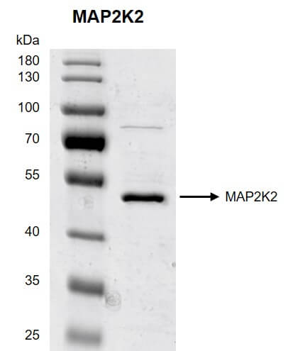 Recombinant MAP2K2 protein gel