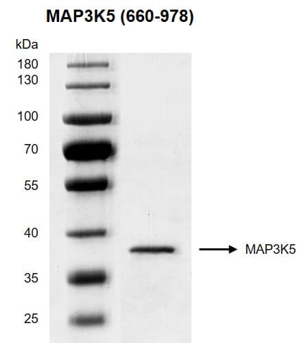 Recombinant MAP3K5 (660-978) protein gel
