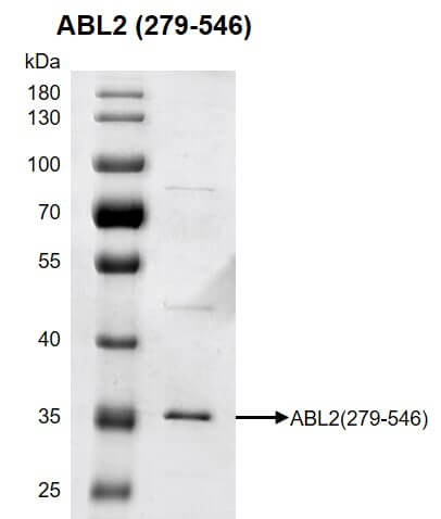 Recombinant ABL2 (279-546) protein gel