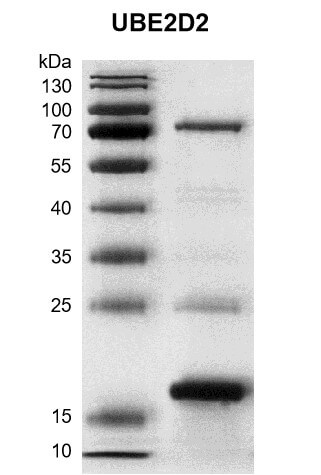 Recombinant UBE2D2 protein gel.
