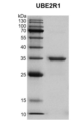 Recombinant UBE2R1 protein gel.