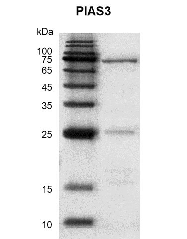 Recombinant NSUN1 protein