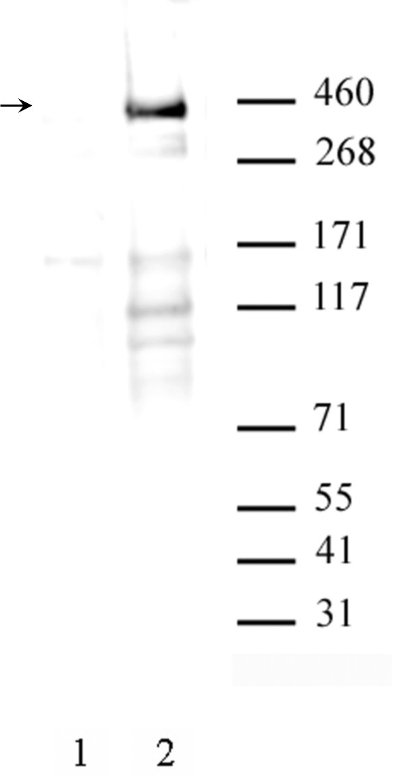 AbFlex<sup>&reg;</sup> ATM phospho Ser1981 antibody (rAb) tested by Western blot.