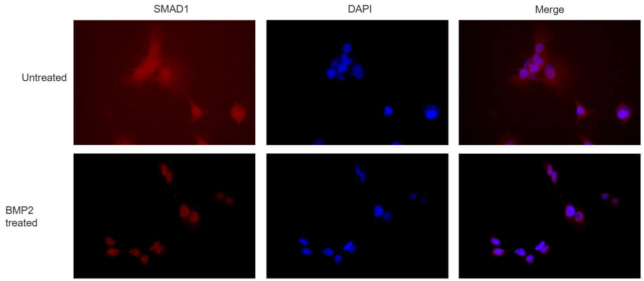 AbFlex<sup>®</sup> SMAD1 antibody (rAb) tested by immunofluorescence.