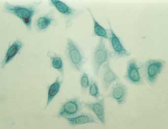 Staining of HeLa cells using the Beta-Galactosidase Staining Kit