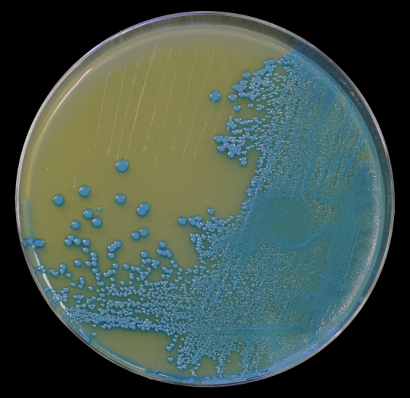 Competent Cells Plated